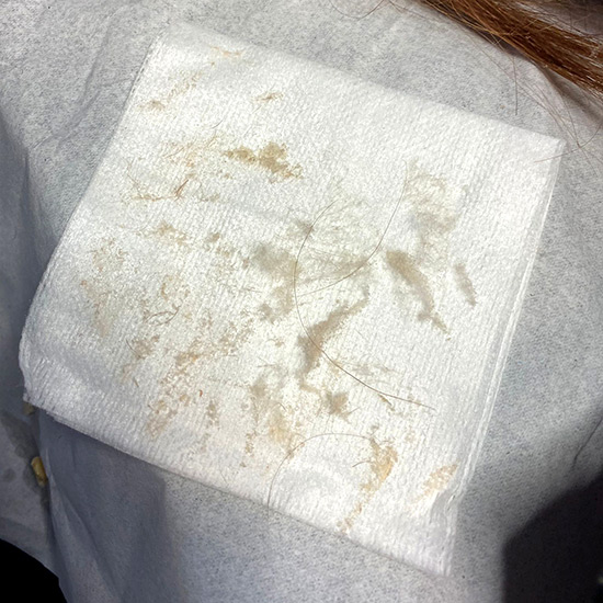 Napkin with skin and fine hairs from the Dermaplaning facial
